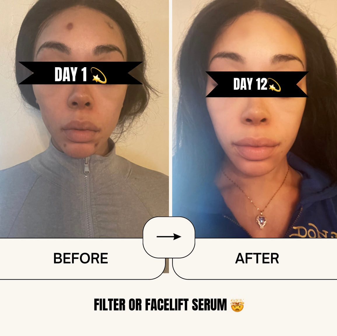 FILTER OR FACELIFT? MILK POTION SERUM