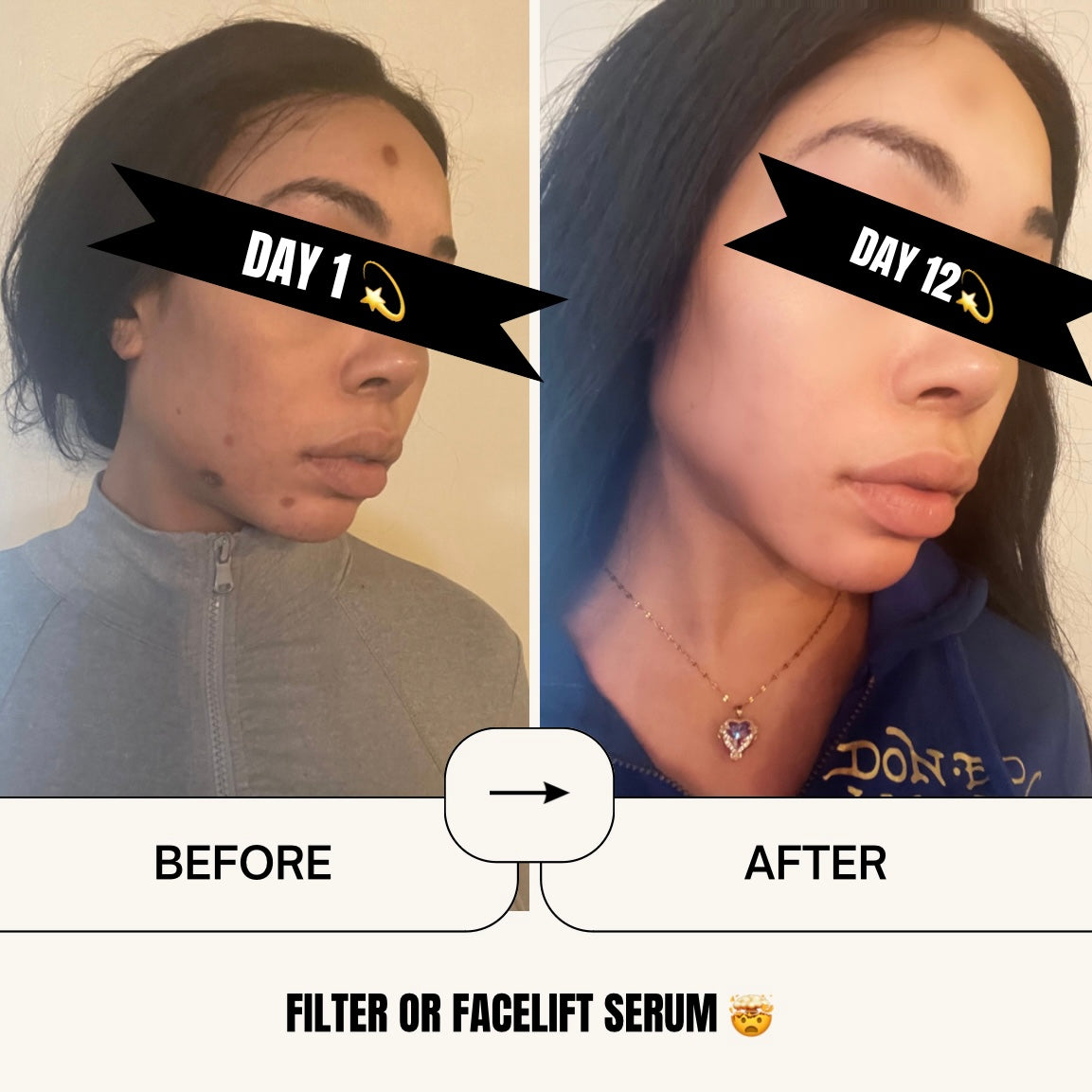 FILTER OR FACELIFT? MILK POTION SERUM