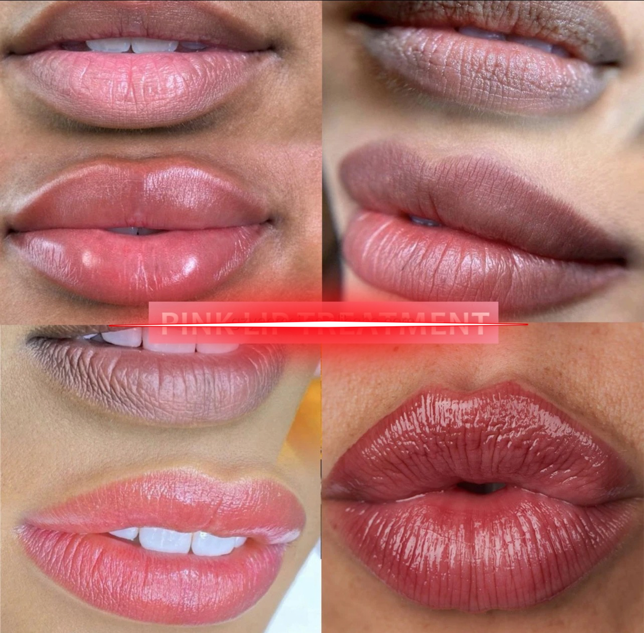 PINK LIP TREATMENT